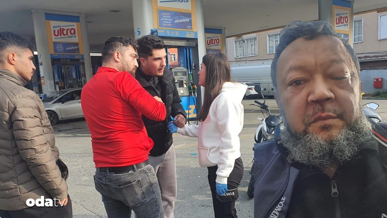 istanbulda cocuga siddete mudahale eden uygurlu baskani hastanelik ettiler Sx6DCTuz.jpg